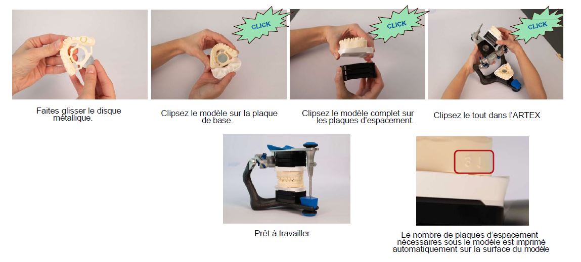 Artex Print&Click, Set de démarrage | BIOSUMMER Dental