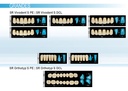 Formes Dents SR Vivodent S DCL