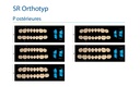 Formes Dents SR-AD Orthotyp postérieures