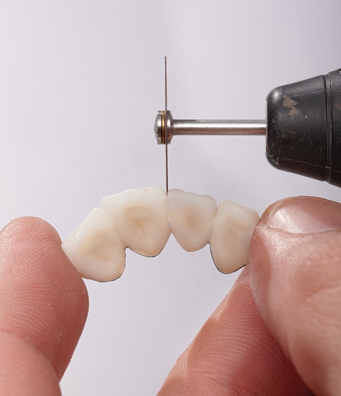 Dynex Brillant Disque de sépar 20 x 0,25 mm, 10 pce.