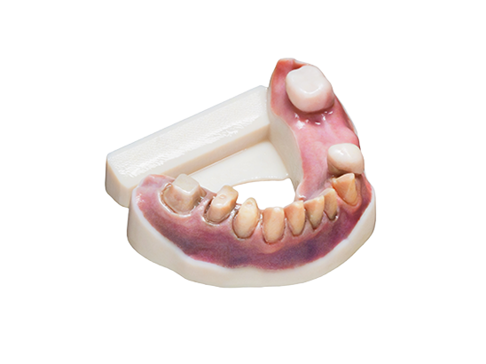 Résine DentaJet Couleurs Vero Vivid Jaune RGD838