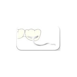 Crochets pour Molaires JM 1,2mm SCHEU  (x10)