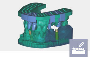 Exocad Module Modèle - licence perpétuelle