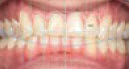 Exocad Module Smile Creator - licence perpétuelle