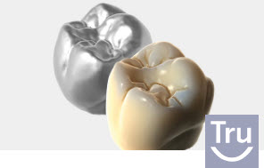 Exocad Module TruSmile - licence perpétuelle