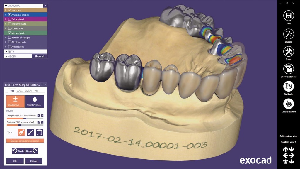 Exocad DentalCAD pack Lab Avancé - abonnement annuel