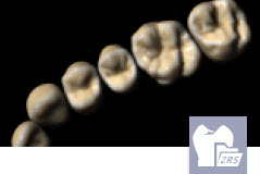 [EXO-ADDON-ZRS-FLEX-Y] Exocad Module Librairie de Dents - abonnement annuel