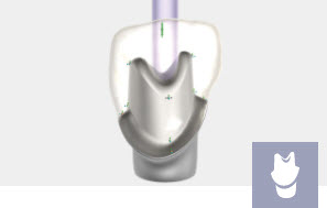 [EXO-ADDON-IMPLA-PERP] Exocad Module Implant - licence perpétuelle