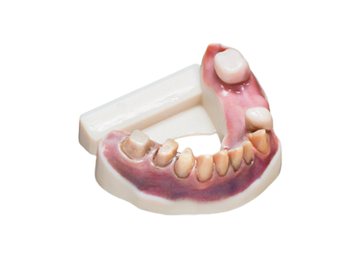 [STRA_OBJ-09129] Résine DentaJet Couleurs Vero Vivid Magenta RGD852