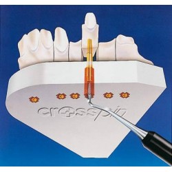 [4308] CROSSPINS Avec Gaines (x1000)